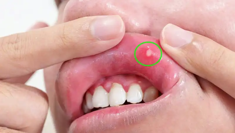 B Vitamini Eksikliği Belirtileri: Vücudun Gizli İhtiyaçları