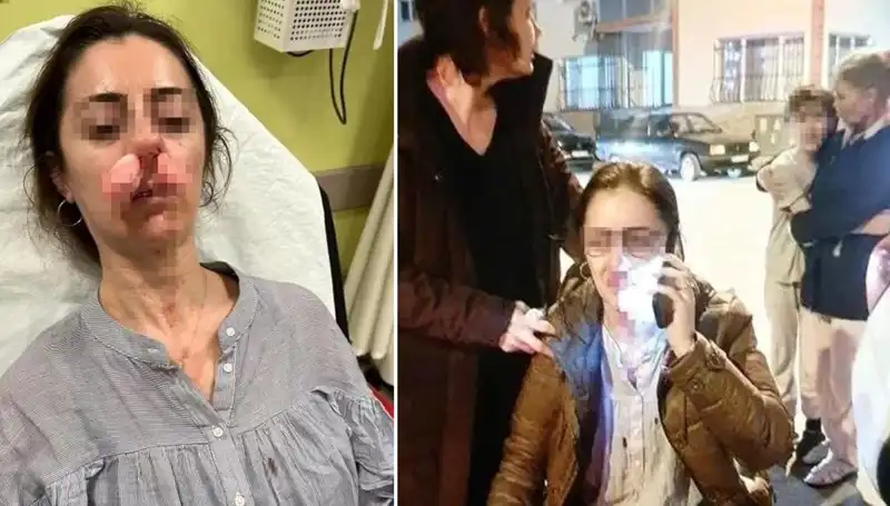 Eşinin Sevgilisini Yanlışlıkla Hedef Alan Adam, Kapıyla Saldırdı!