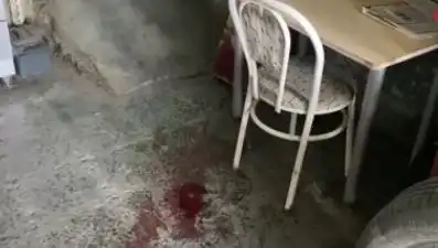 Sandalyeden Düşen Adamın Hayatı Değişti: Yaşadığı Kaza ve Sonrası