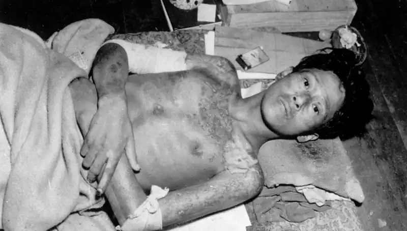 80 Yıl Sonra Nagasaki’den Korkutucu Çağrı: Nükleer Felaketin Eşiğindeyiz