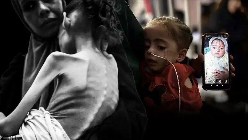 Meryem’in Zavallı Hikayesi: 25 Kilodan 10 Kiloya Düşen Küçük Kızın Mücadelesi