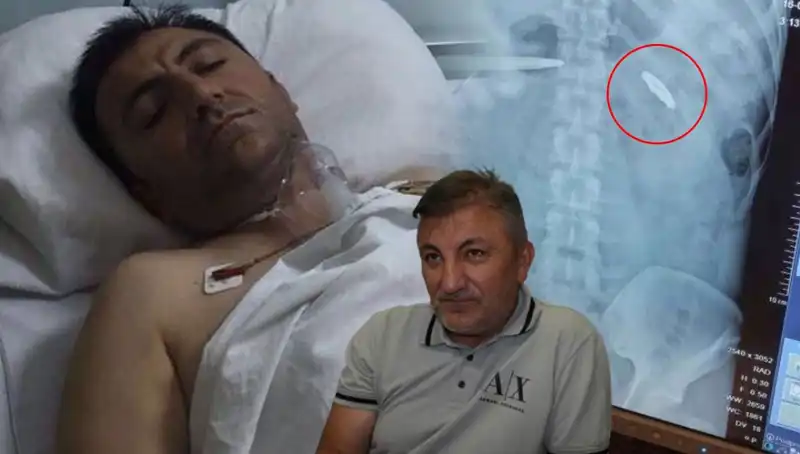 15 Temmuz’un Ardındaki Acı Gerçek: 9 Yıldır Kurşunla Yaşamak